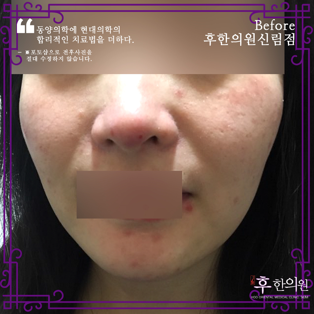 Before