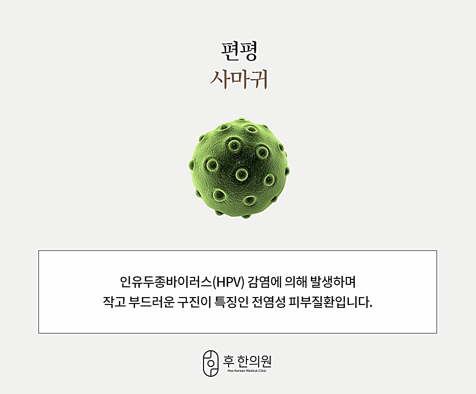편평사마귀란 인유두종바이러스(HPV) 감염으로 생기는 작고 부드러운 구진성 피부질환