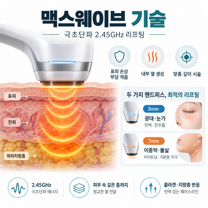 신림온다리프팅 맥스웨이브 극초단파 기술 설명 - 2.45GHz 리프팅, 표피 손상 부담 적음, 내부 열 생성, 맞춤 핸드피스