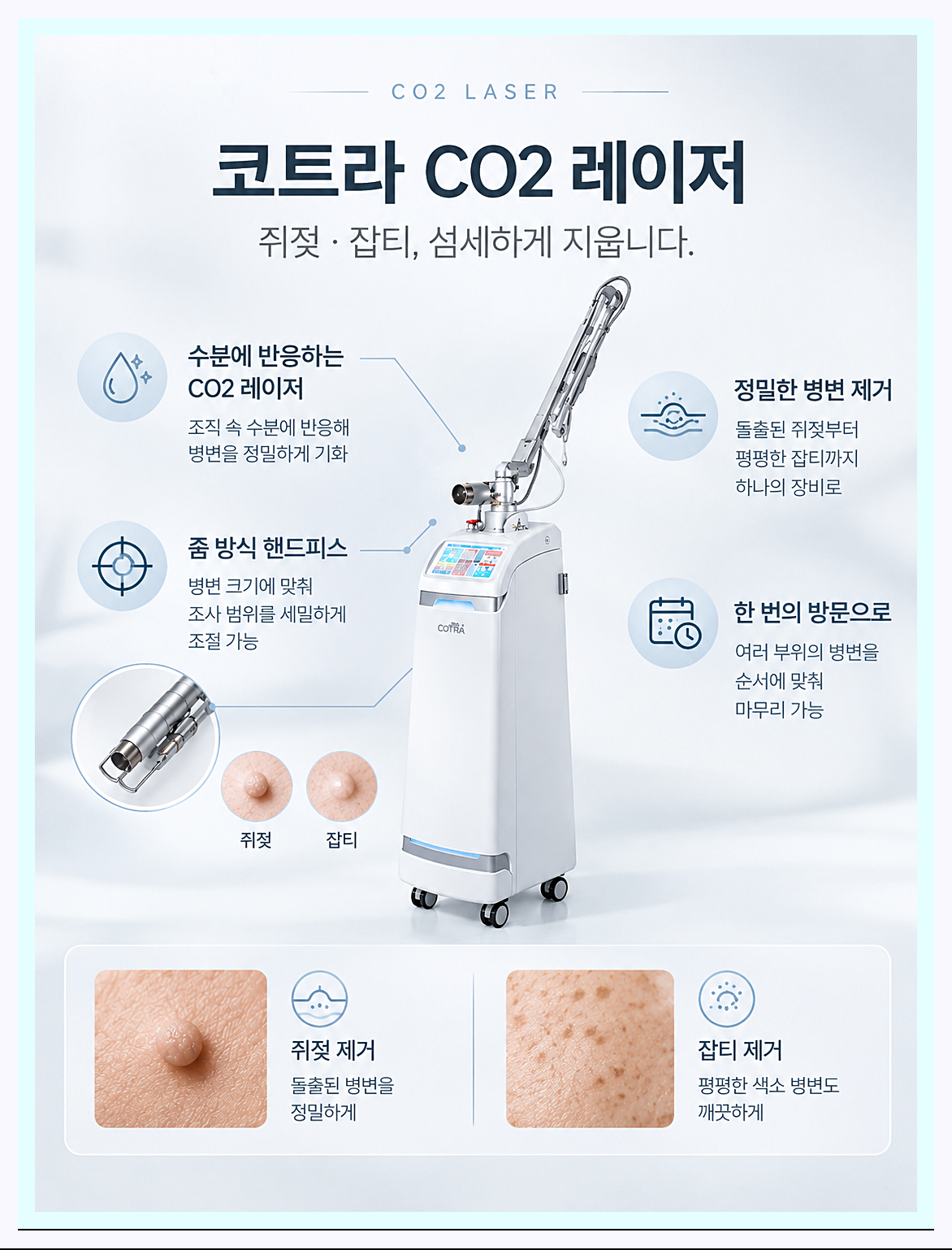 코트라 레이저의 설명