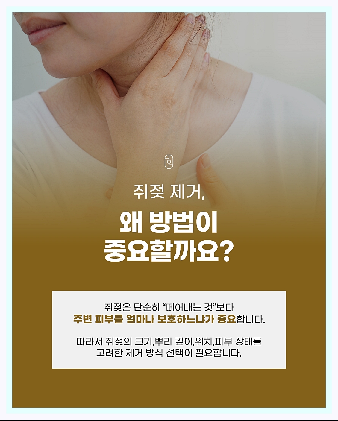 신림쥐젖잡티 제거 방법에 대한 중요성 강조 이미지