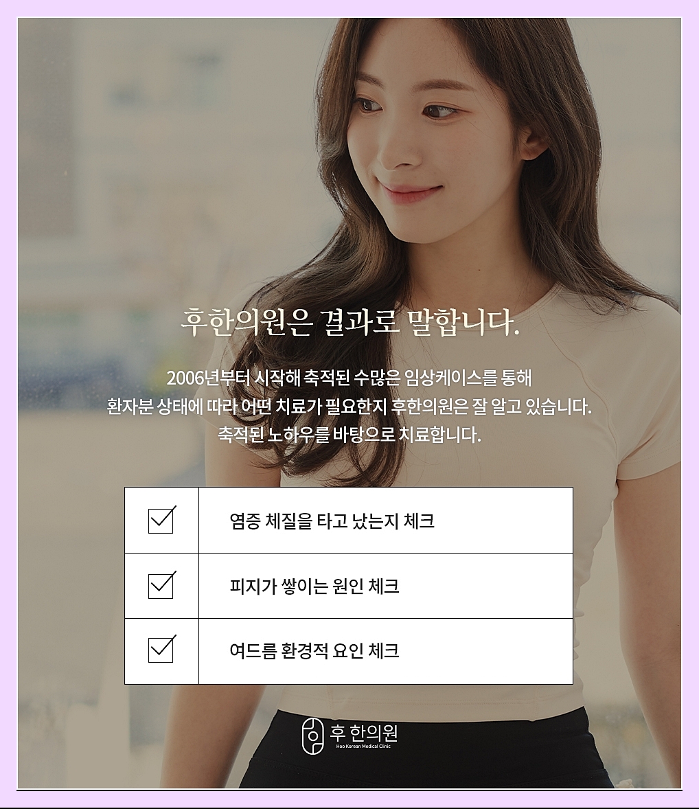 여드름의 다양한 원인을 조사하는 항목 이미지