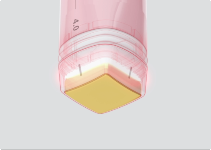 신림 볼뉴머 팁
