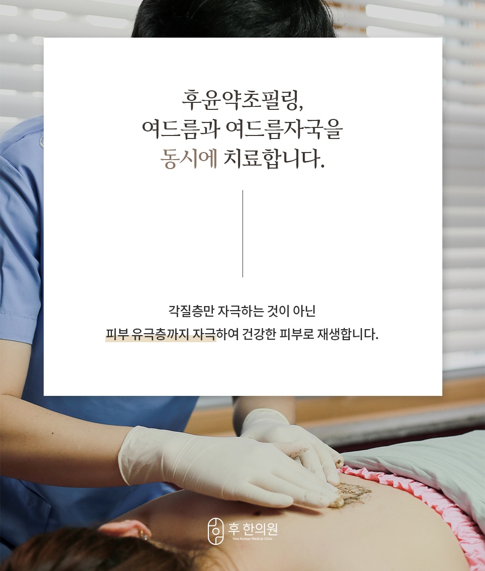 후윤약초필링 여드름 및 자국 동시 치료
