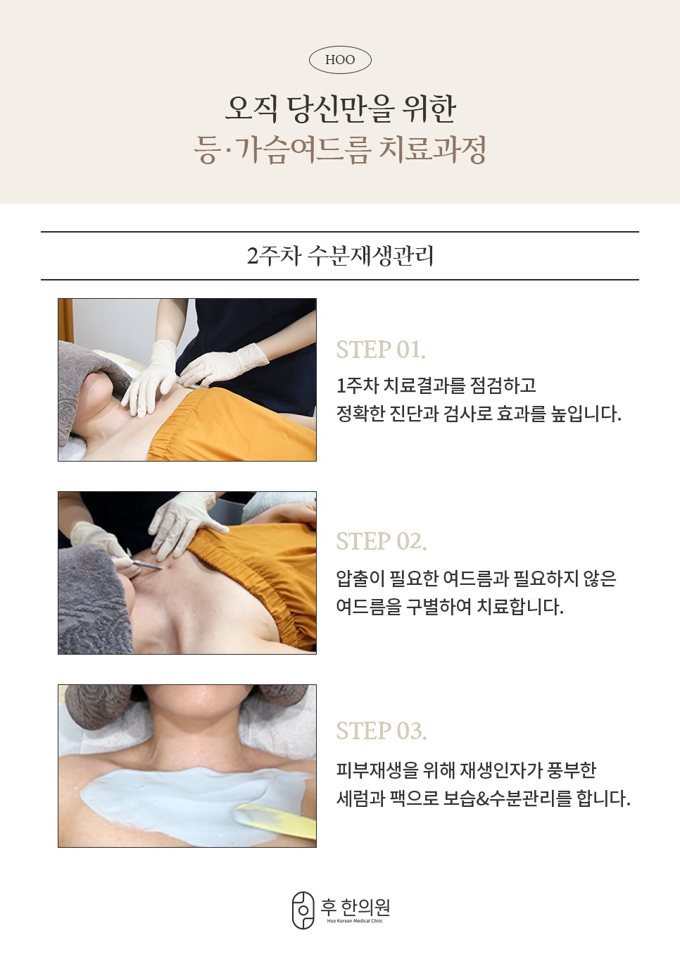 등가슴여드름 2주차 수분재생관리 과정