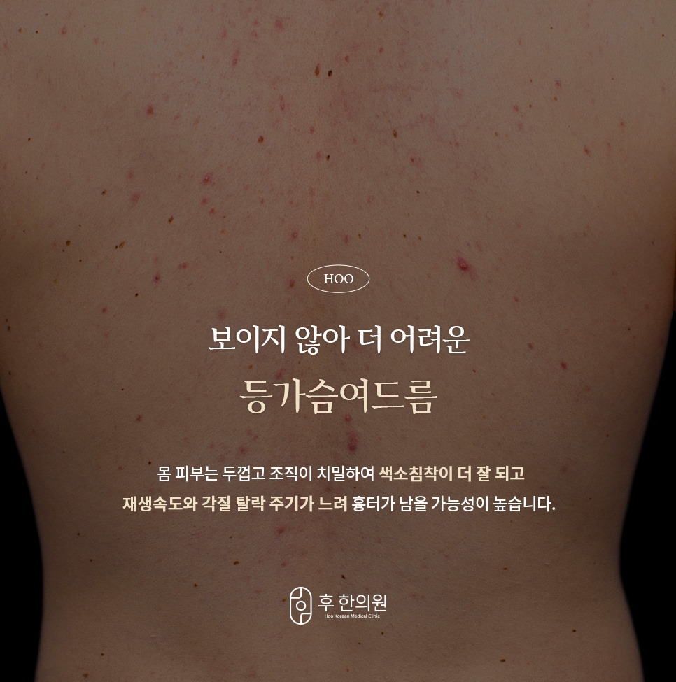 제가 이미지를 정확히 확인하지 않고 이전 답변을 드려 정말 죄송합니다.  보내주신 카드뉴스 8장에 들어있는 텍스트와 내용에 정확히 일치하는 알트태그를 이미지당 1개씩 정리했습니다.  [신림 등가슴여드름 카드뉴스 알트태그 (8장)] 1번 이미지 (1_5.jpg): 보이지 않아 더 어려운 등가슴여드름 특성