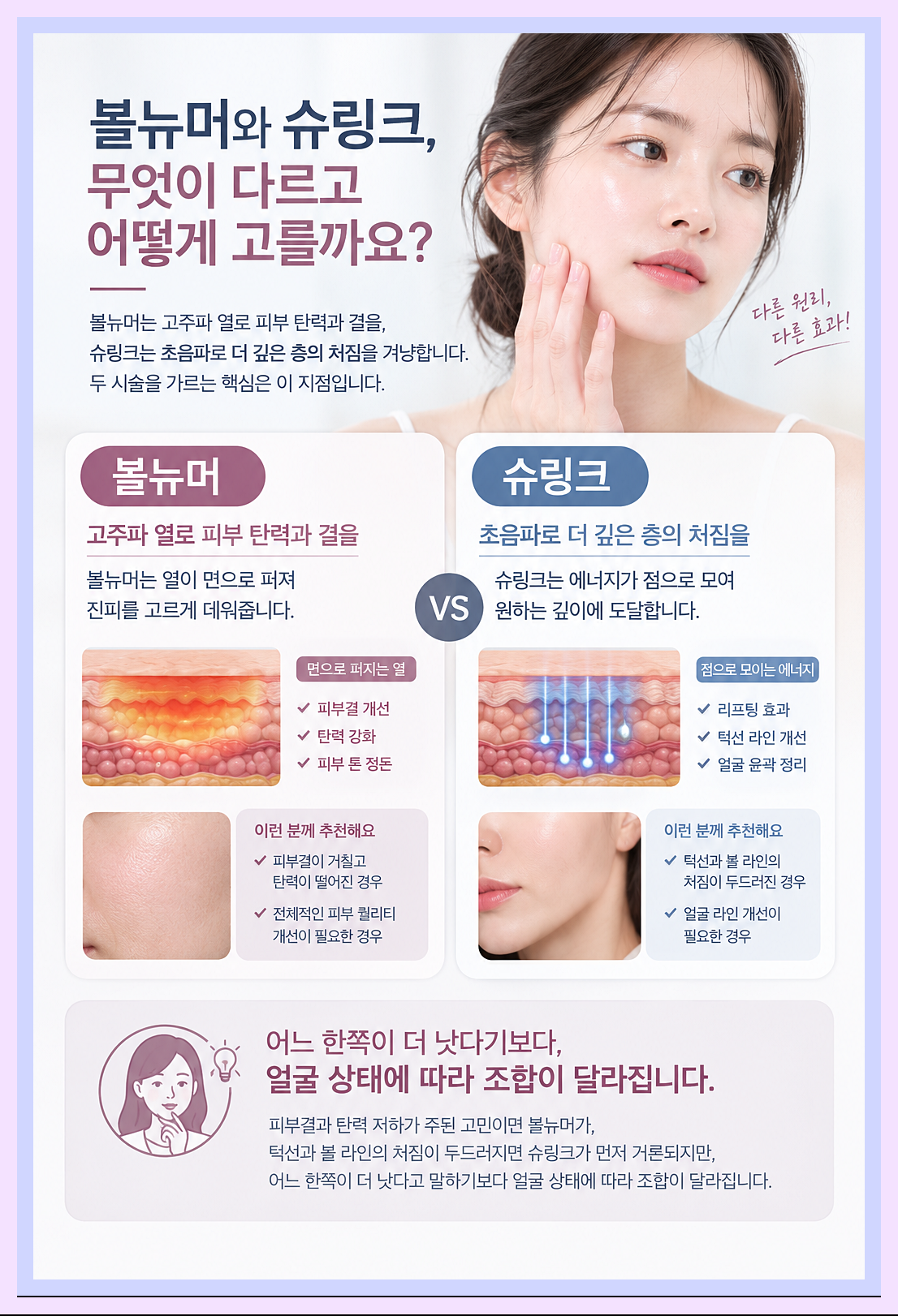 볼뉴머와 슈링크 차이