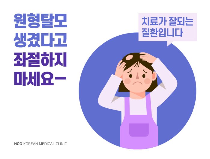  원형탈모로 고민하는 여성 일러스트, 신림원형탈모 치료 안내
