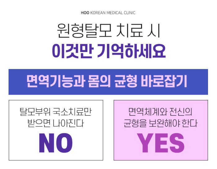 원형탈모 치료 시 국소치료보다 면역체계와 전신 균형 보완이 중요하다는 안내
