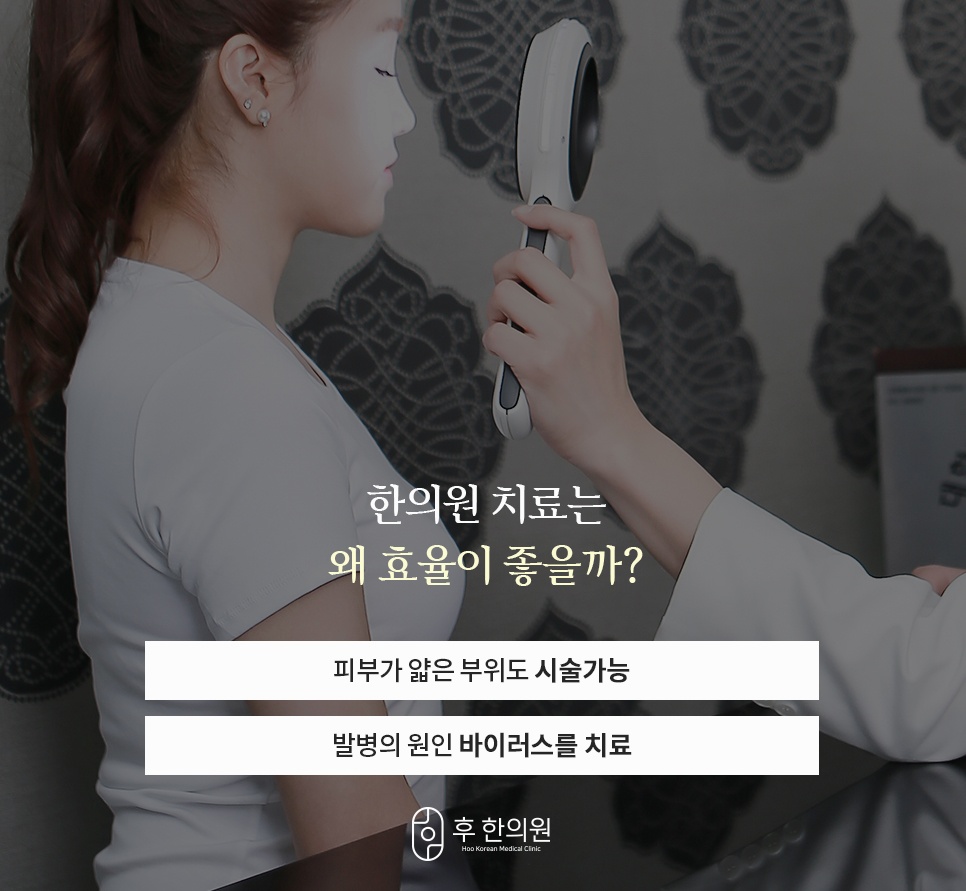 손거울형 확대경으로 피부를 살피며 얇은 부위 시술과 바이러스 치료를 안내하는 이미지