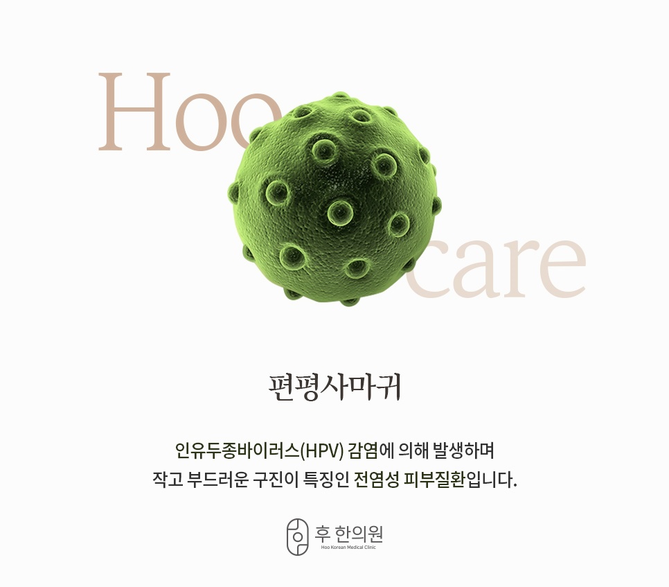 초록색 바이러스 구체 이미지로 보는 HPV 감염성 피부질환 편평사마귀 소개